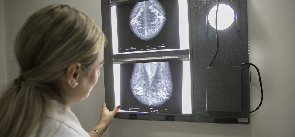 Así puede la inteligencia artificial ayudar a la detección del cáncer de mama