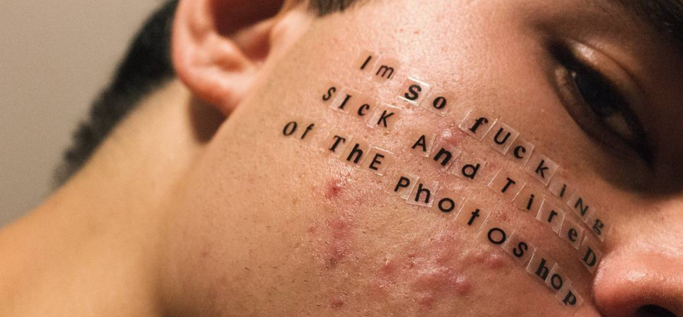 El fotógrafo que quiere normalizar el acné